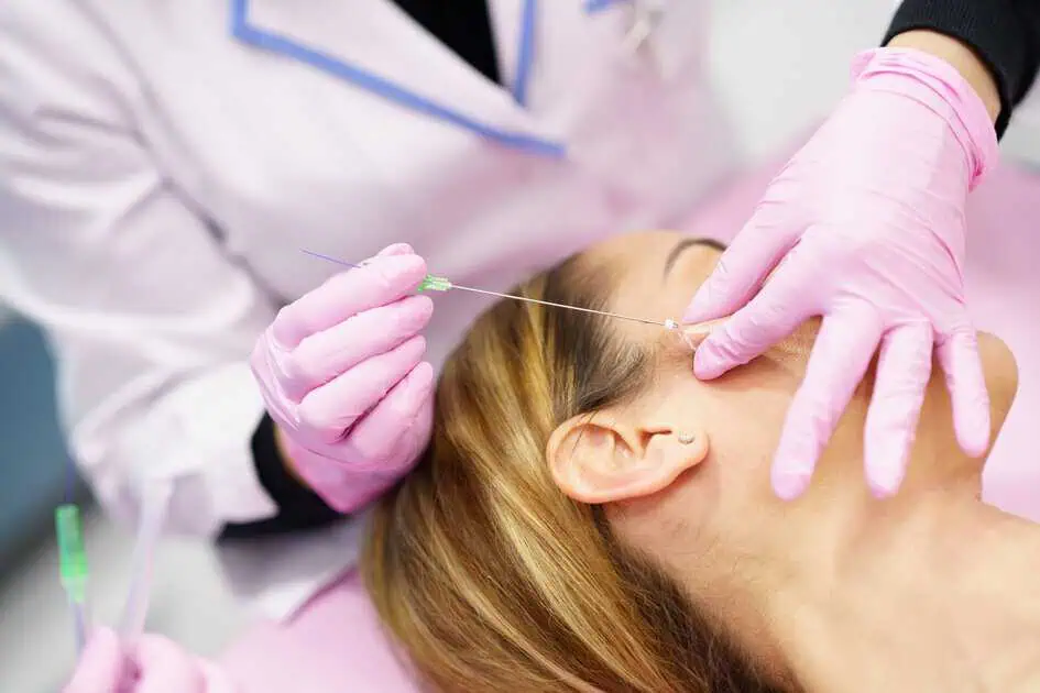 PDO Max Thread Lift in Tulsa, Ok by Aging Backwards Medical